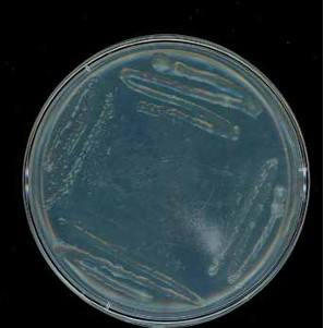 Images on this page and facing page are of a set of isolation streaks and dilution plates used to procure bacteria in Friesen and James’ research